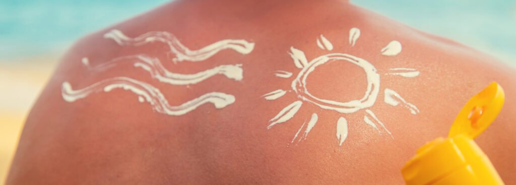 Sun and waves drawn with sunscreen on a sunburnt back