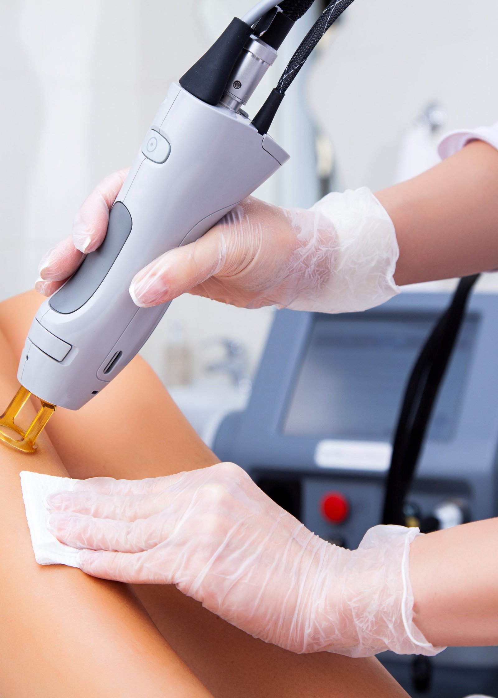 Close-up of a female cosmetologist in a medical coat making a young woman  a procedure laser hair removal for leg. Cosmetology, ionization, diamond procedures.