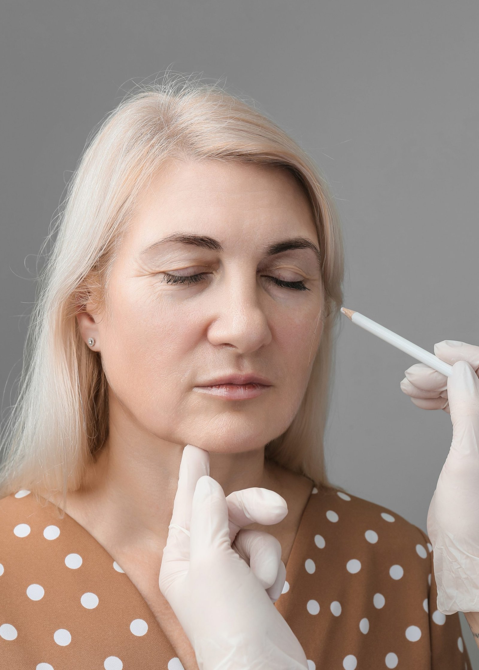 Thread facelift, concept of lifting skin. Procedure facial contouring using mesothreads. A beautician in gloves makes markings with a white pencil on a woman's face for the introduction of fillers